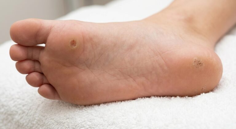 Konnasilm või soolatüügas: kuidas neil vahet teha?